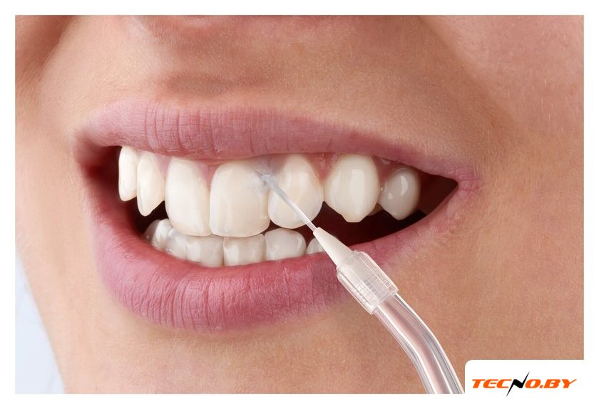 Ирригатор  Sencor SOI 1311GD - Изображение №4 — Интернет-Магазин TECNO.BY